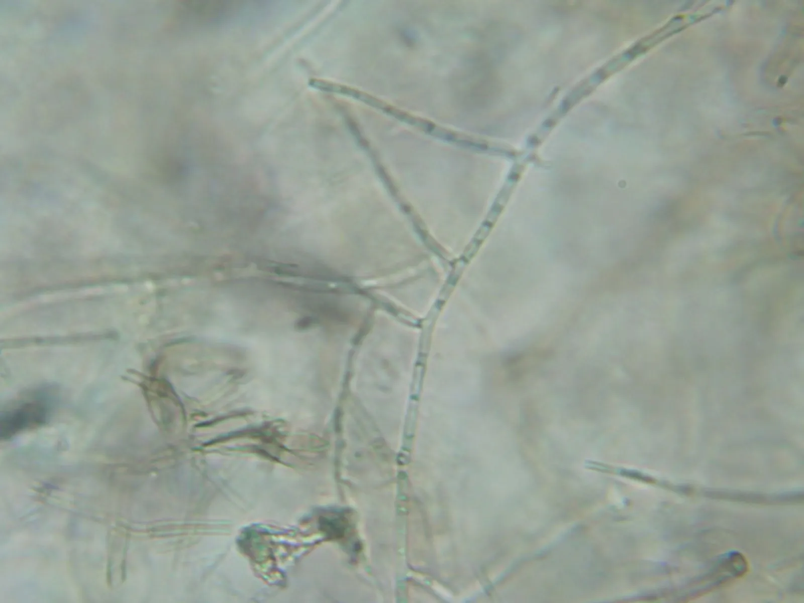 ផ្សិត Rhizoctonia solani