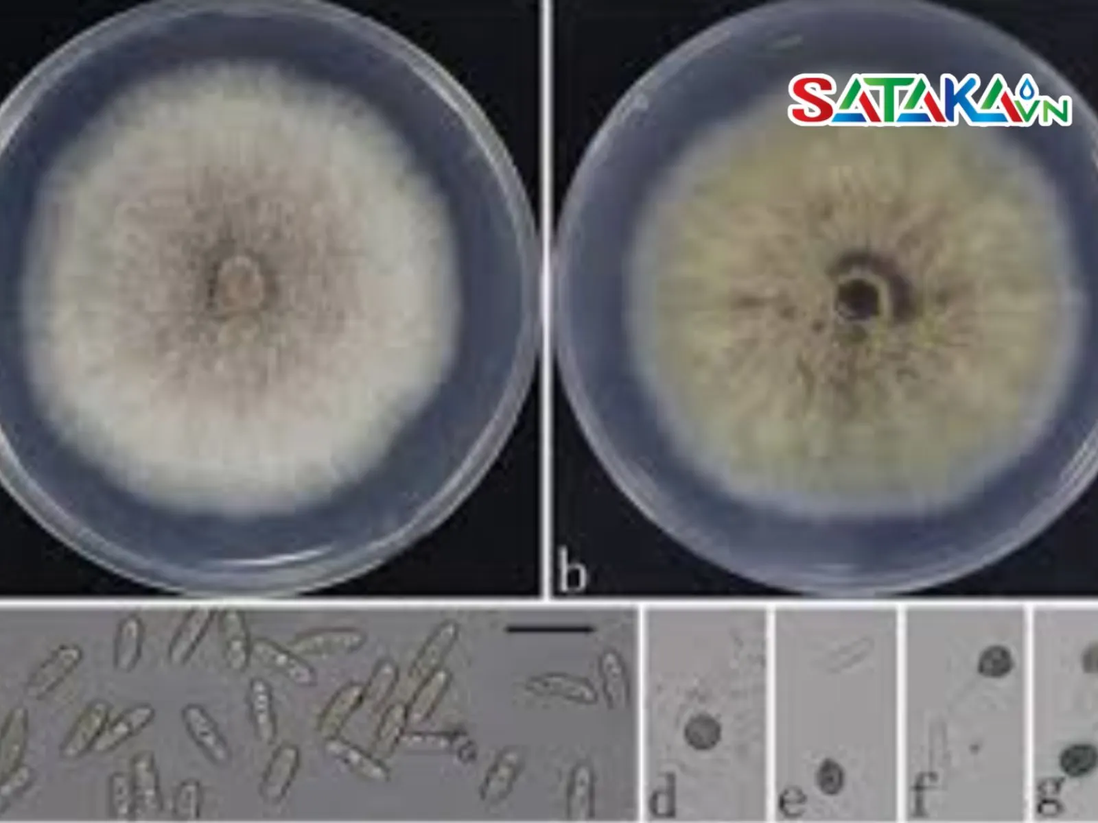 Nấm Colletotrichum spp.